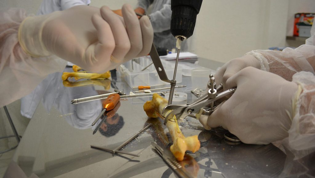 Person holding knee with highlighted bones and joints, illustrating orthopedic pain or treatment