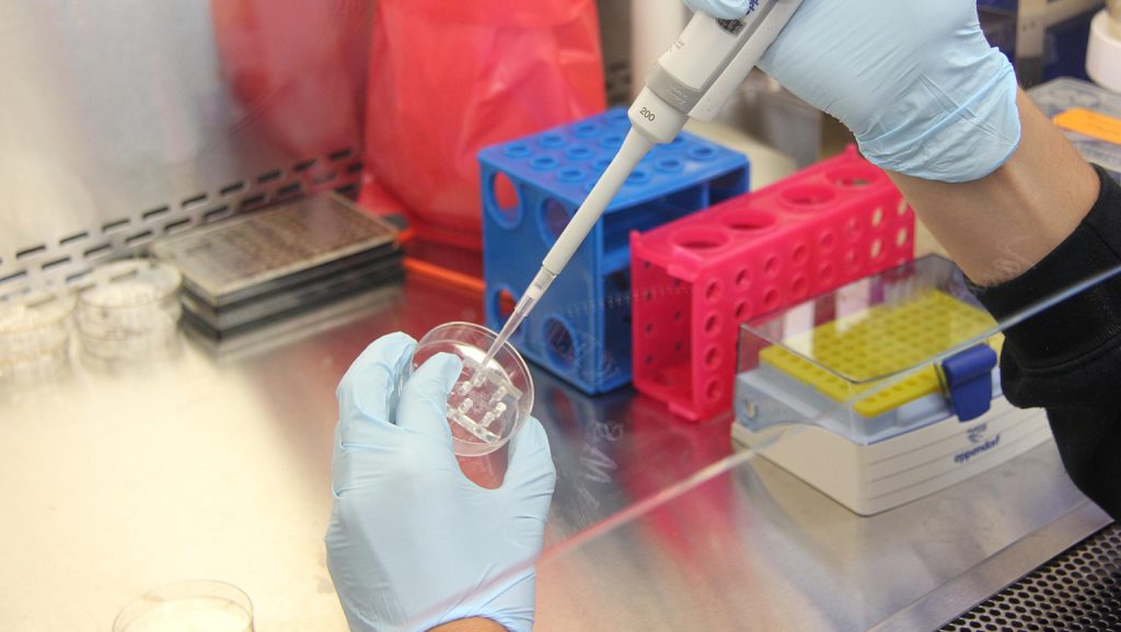 Tuberculosis laboratory at Tarlac Medical Center performing TB lab tests and Mycobacterium tuberculosis identification