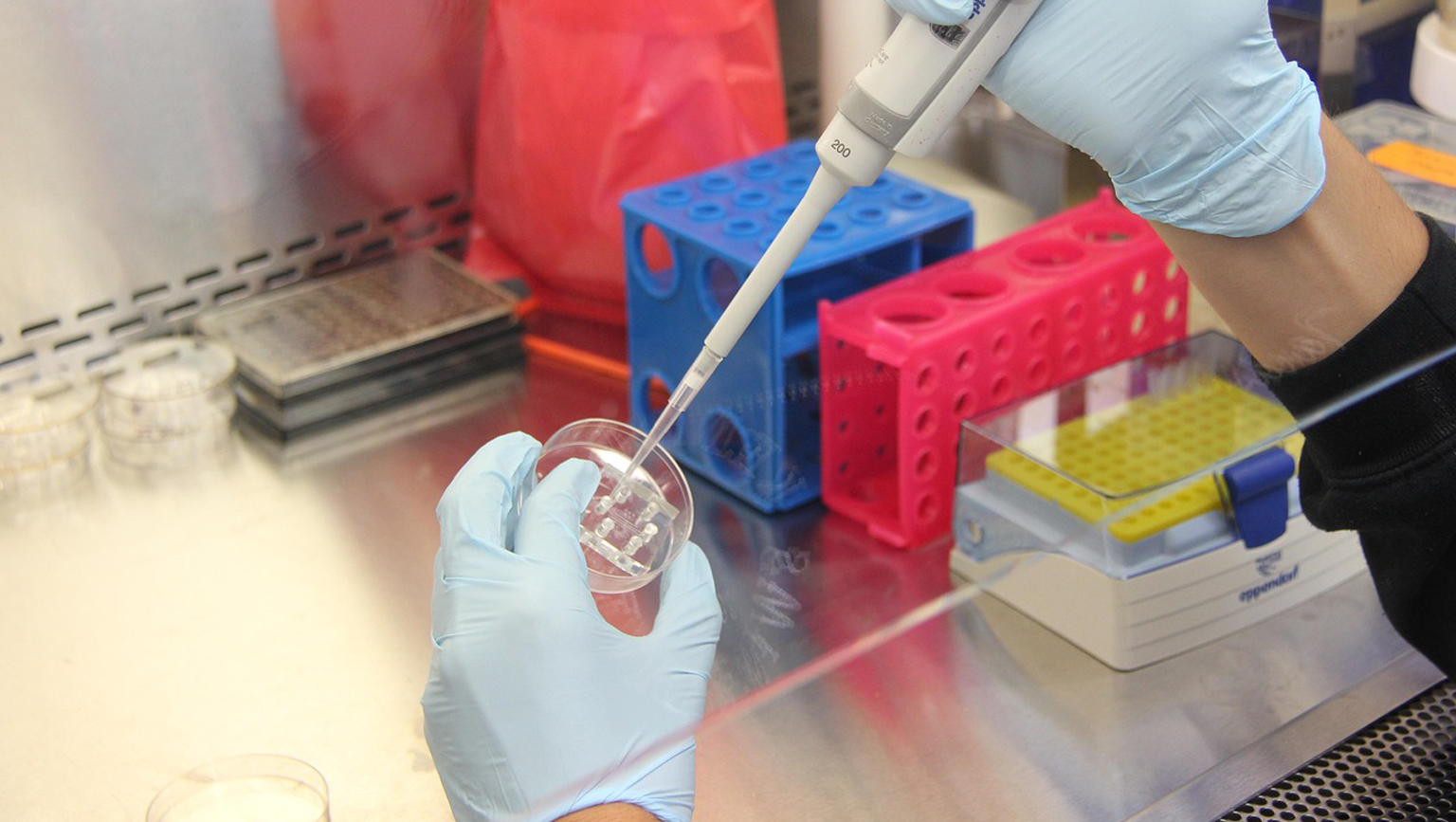 TUBERCULOSIS LABORATORY