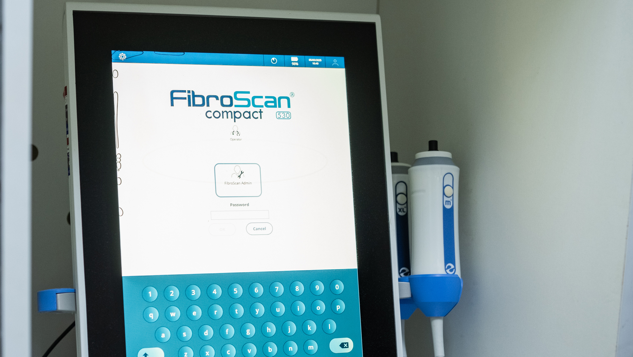 FibroScan machine used for fatty liver assessment