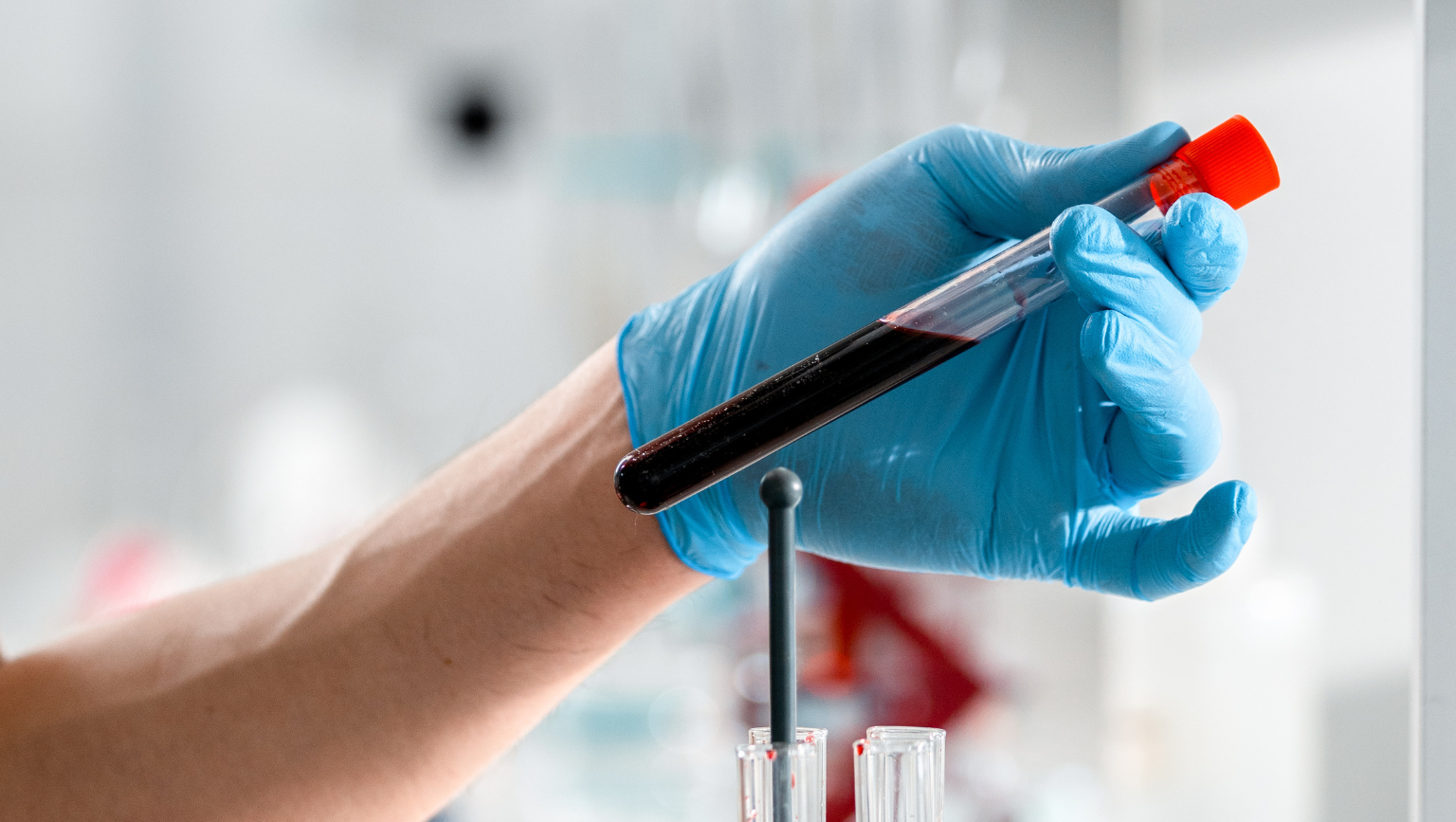 TUBERCULOSIS LABORATORY