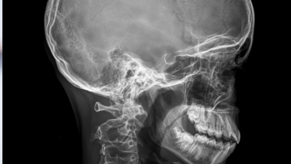 Neurovascular and Skull Base Surgery