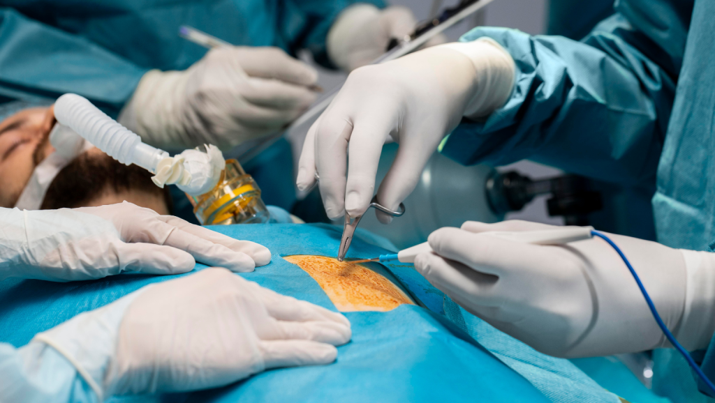 Hernia Repair Surgery