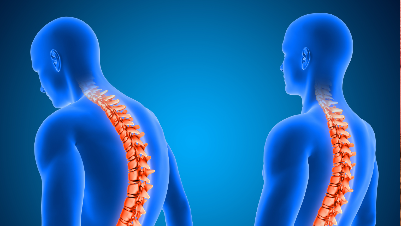 Ankylosing Spondylitis (AS) Treatment in Tarlac