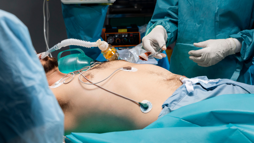 Gallbladder Removal Surgery (Cholecystectomy)